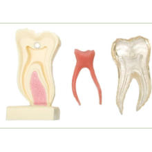 Anatomic Profile Model of Mandibular Molar